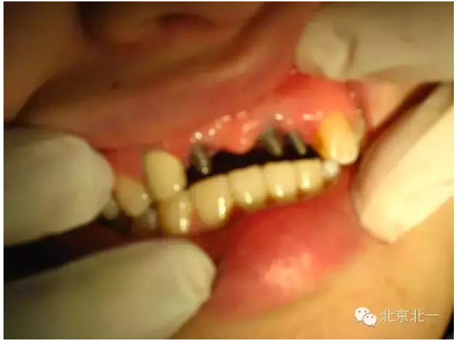 QQ圖片20150803113102.png QQ圖片20150803113102.png