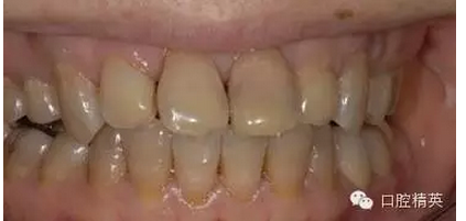 QQ圖片20150803105939.png QQ圖片20150803105939.png