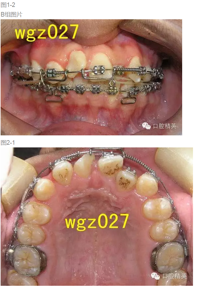 QQ圖片20150808142658.png QQ圖片20150808142658.png