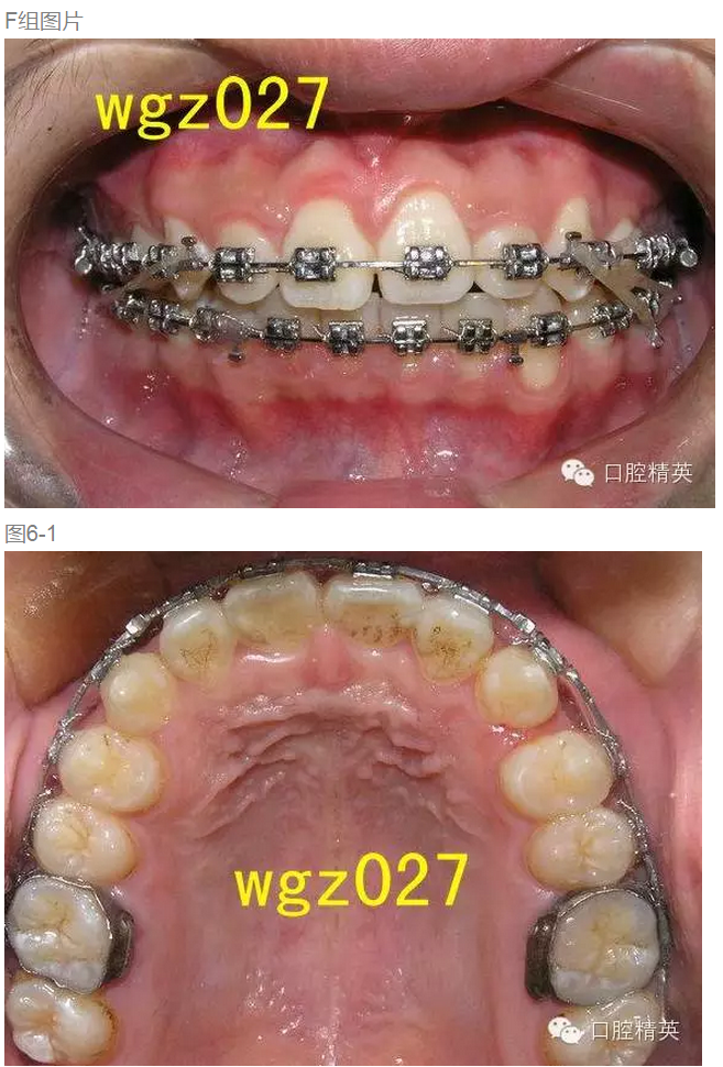 QQ圖片20150808142805.png QQ圖片20150808142805.png