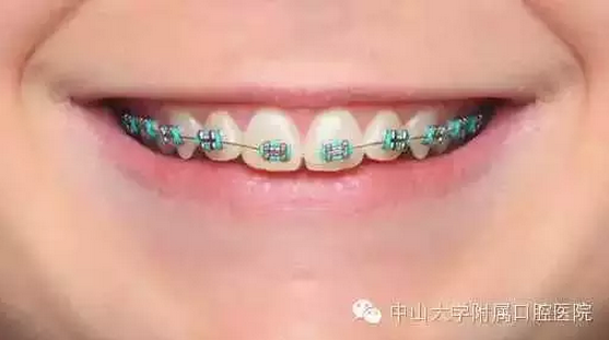 QQ圖片20150810102244.png QQ圖片20150810102244.png