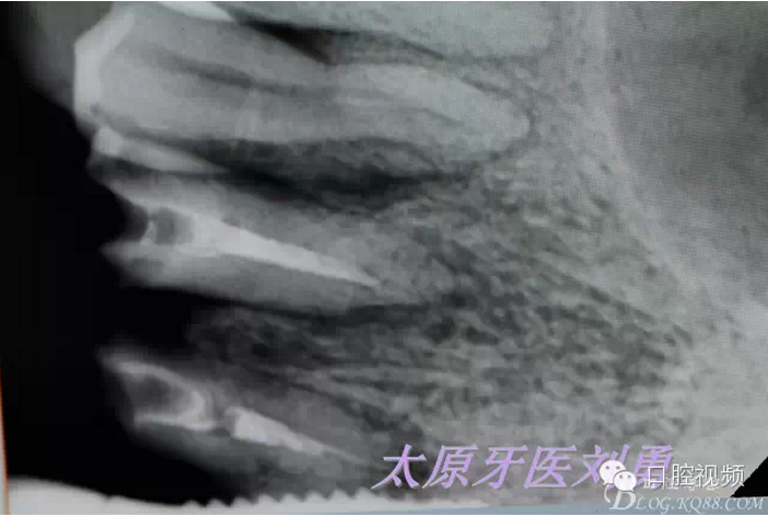 QQ圖片20150811100318.png QQ圖片20150811100318.png