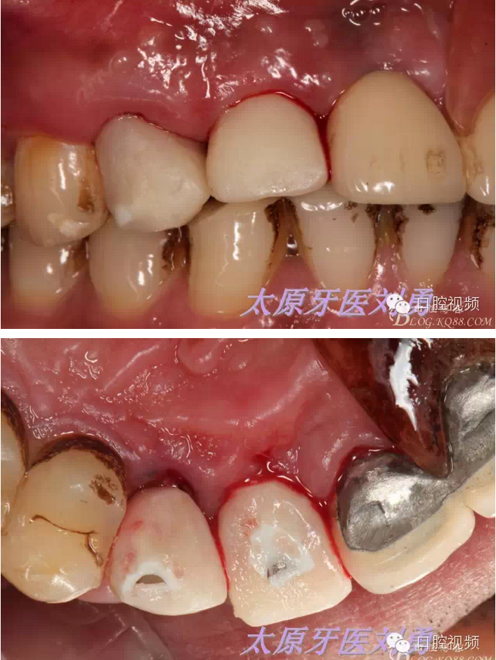 QQ圖片20150811100355.png QQ圖片20150811100355.png