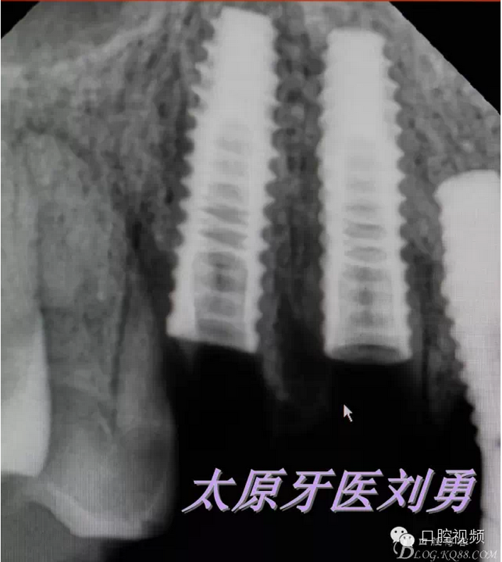 QQ圖片20150811100411.png QQ圖片20150811100411.png