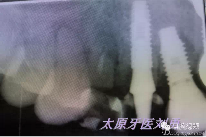 QQ圖片20150811100423.png QQ圖片20150811100423.png