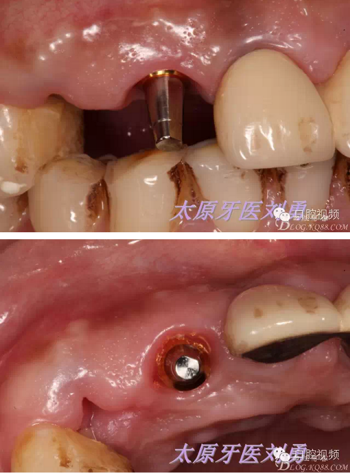 QQ圖片20150811100443.png QQ圖片20150811100443.png