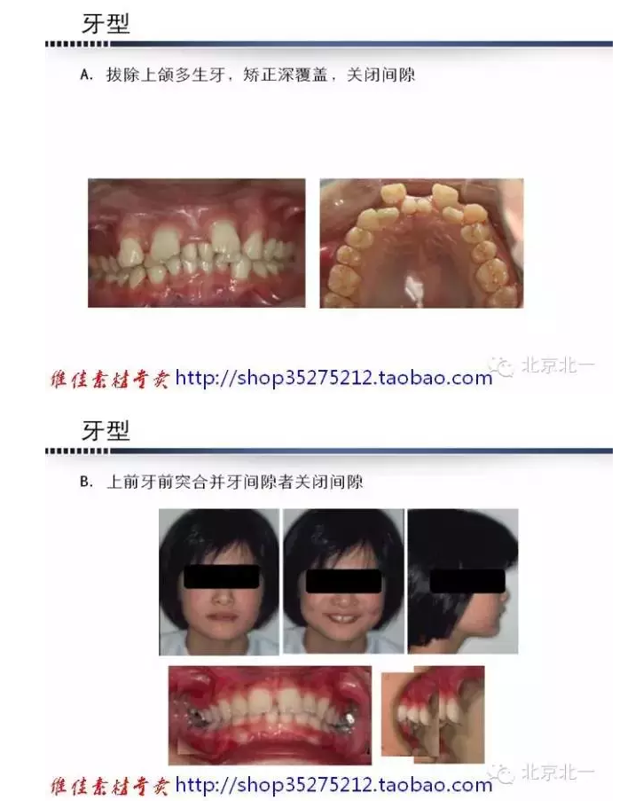 QQ圖片20150824092915.png QQ圖片20150824092915.png