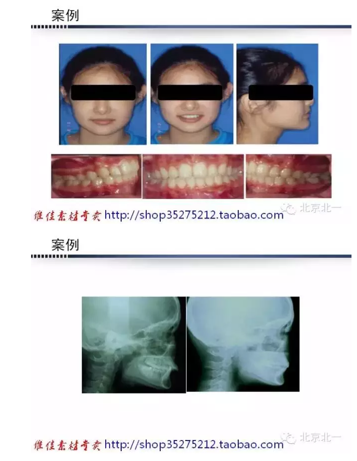 QQ圖片20150824092926.png QQ圖片20150824092926.png