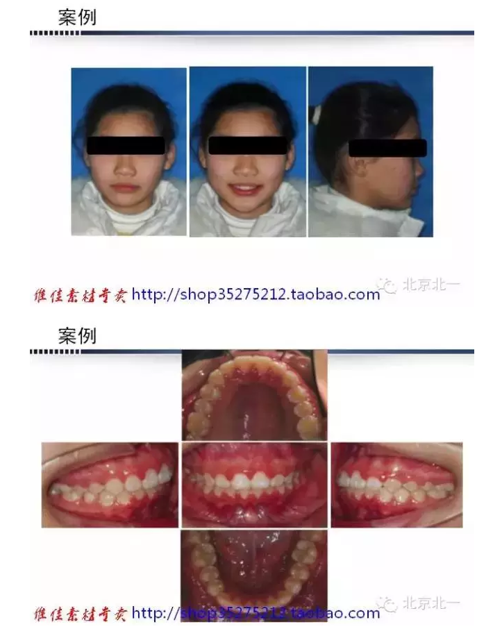 QQ圖片20150824093000.png QQ圖片20150824093000.png