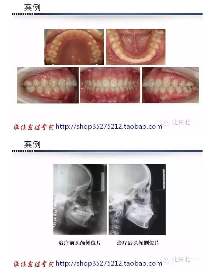 QQ圖片20150824093056.png QQ圖片20150824093056.png