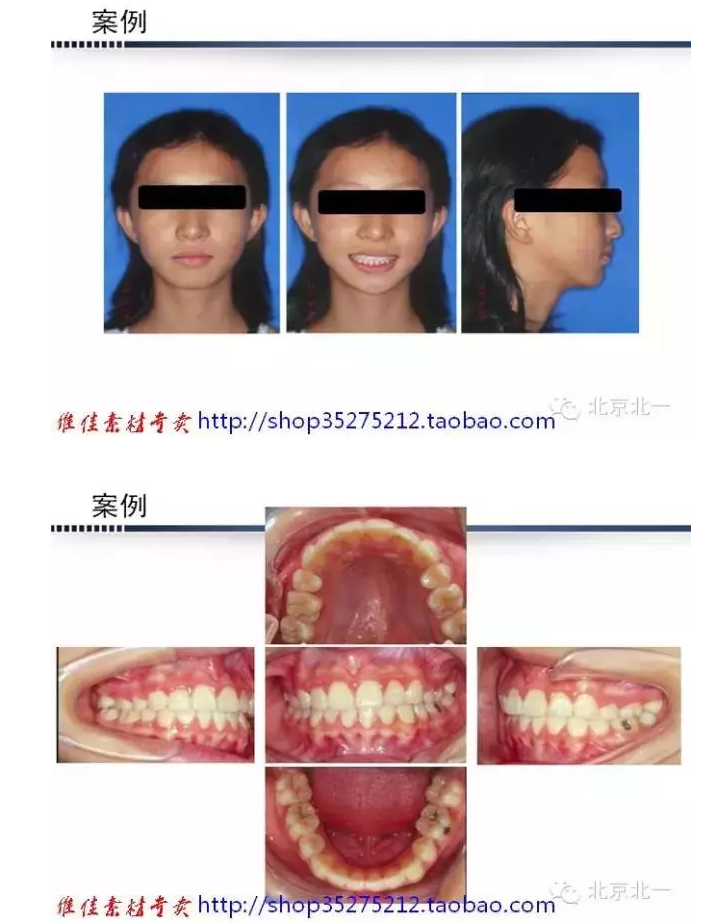 QQ圖片20150824093135.png QQ圖片20150824093135.png