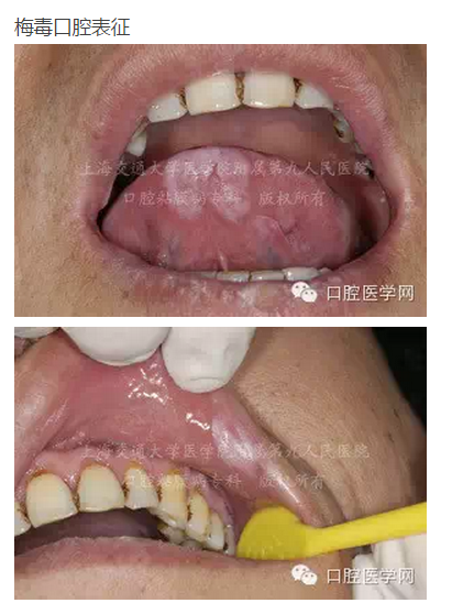 QQ圖片20150824140606.png QQ圖片20150824140606.png