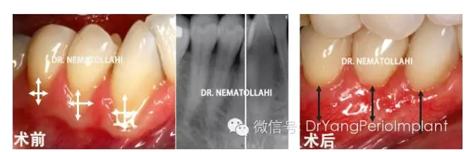 QQ圖片20150824142150.png QQ圖片20150824142150.png