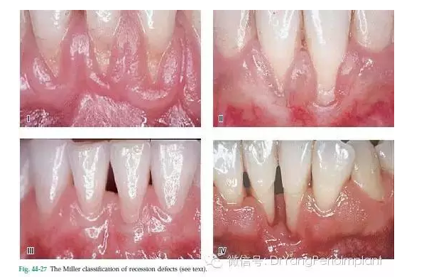 QQ圖片20150824142127.png QQ圖片20150824142127.png