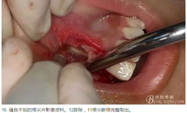 QQ圖片20150825101127.png QQ圖片20150825101127.png