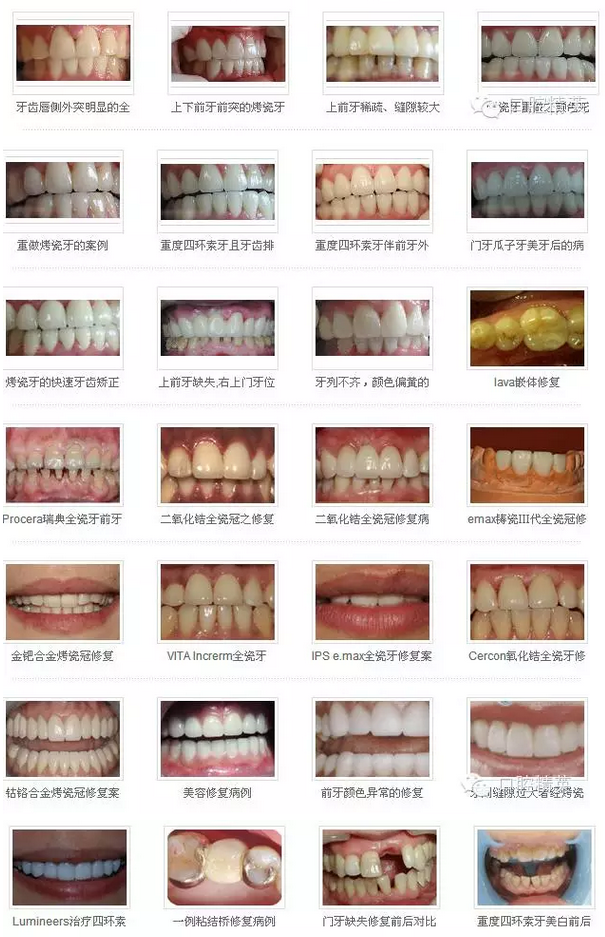 QQ圖片20150825171936.png QQ圖片20150825171936.png