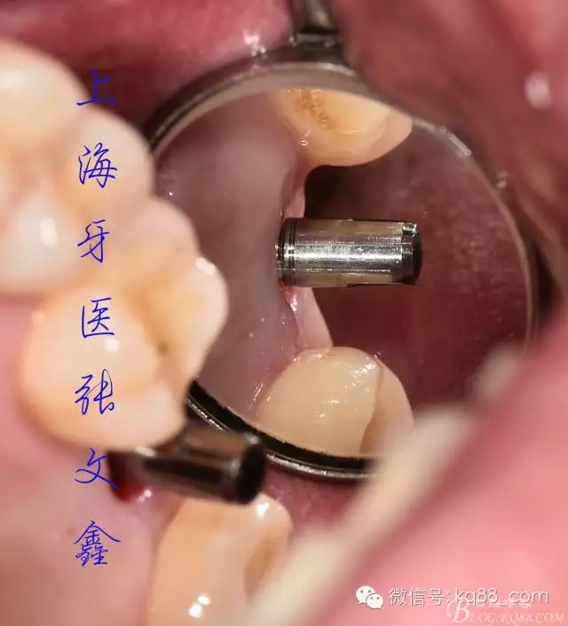 1112.webp.jpg 1112.webp.jpg