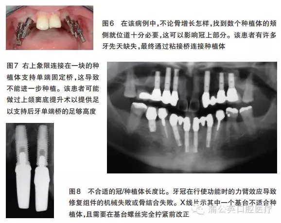 1552.webp.jpg 1552.webp.jpg