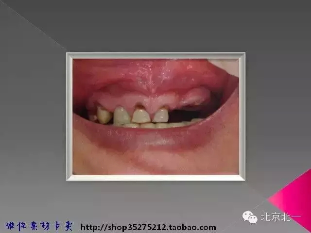 35.webp.jpg 35.webp.jpg