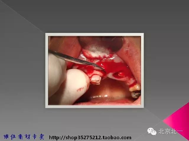 37.webp.jpg 37.webp.jpg