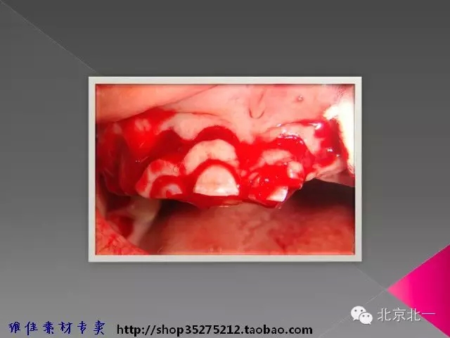 38.webp.jpg 38.webp.jpg