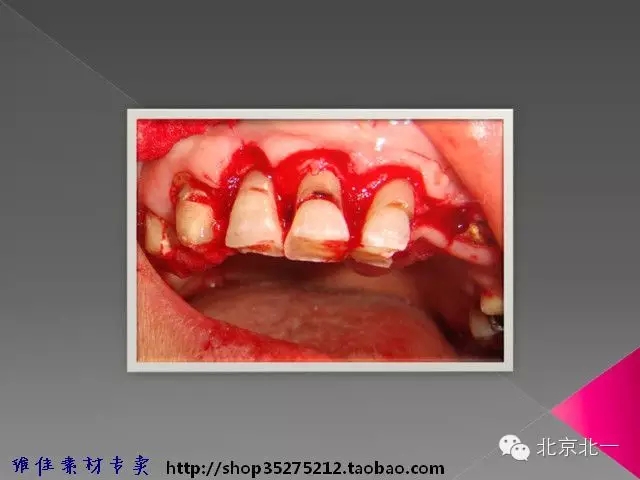 39.webp.jpg 39.webp.jpg