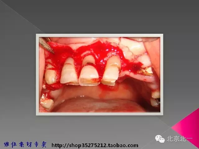 40.webp.jpg 40.webp.jpg