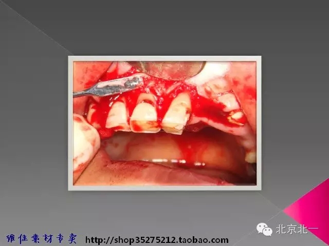 41.webp.jpg 41.webp.jpg