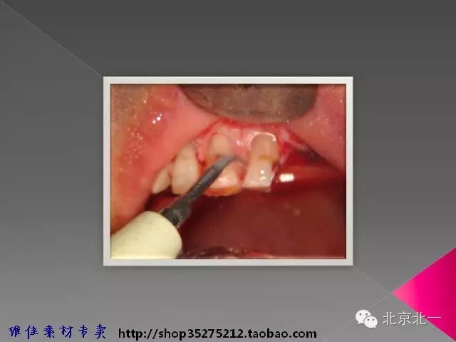 44.webp.jpg 44.webp.jpg