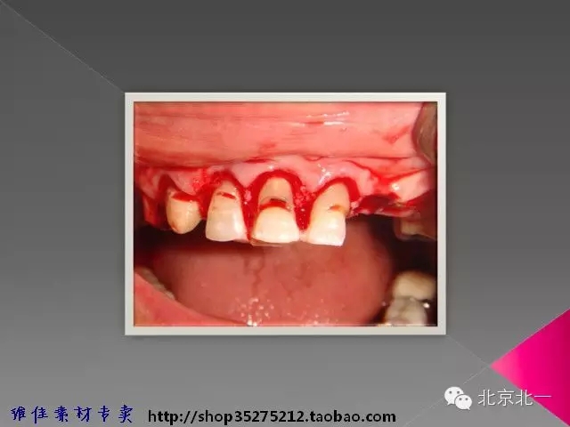 45.webp.jpg 45.webp.jpg