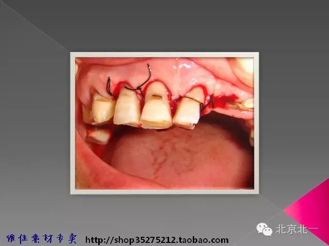 46.webp.jpg 46.webp.jpg