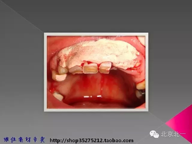 47.webp.jpg 47.webp.jpg