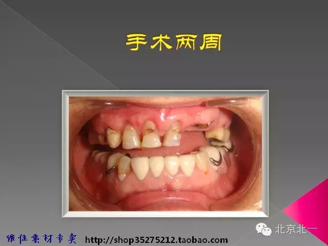 49.webp.jpg 49.webp.jpg