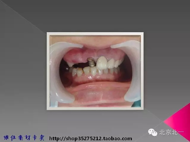 51.webp.jpg 51.webp.jpg