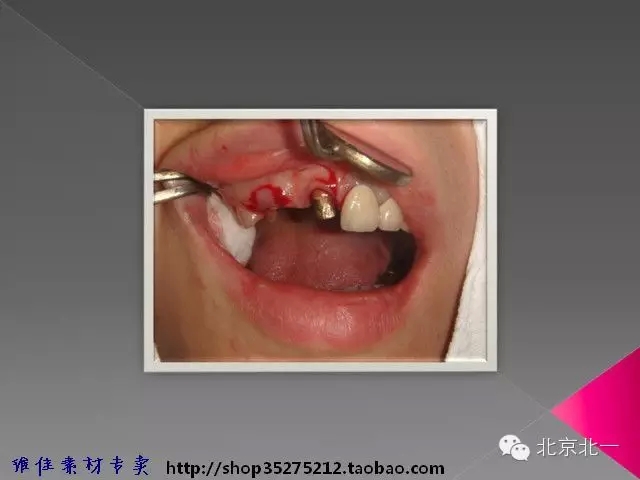 52.webp.jpg 52.webp.jpg