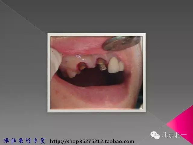 53.webp.jpg 53.webp.jpg