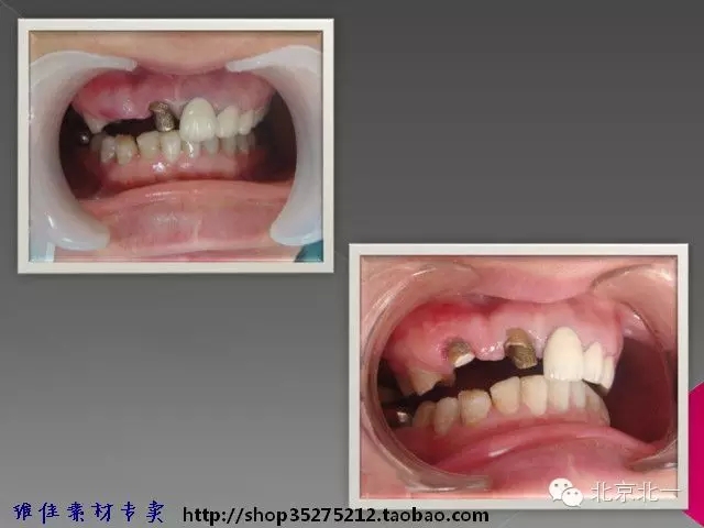 55.webp.jpg 55.webp.jpg