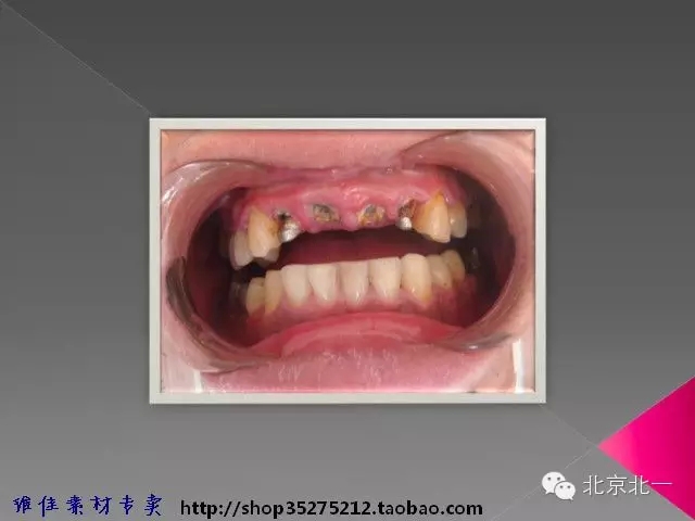 56.webp.jpg 56.webp.jpg