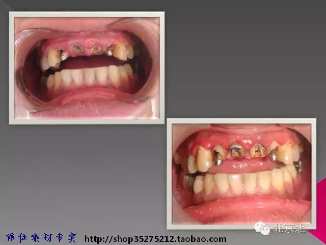 61.webp.jpg 61.webp.jpg