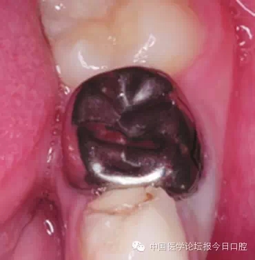 26.webp.jpg 26.webp.jpg