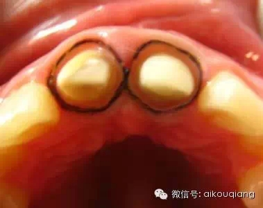 1400.webp.jpg 1400.webp.jpg