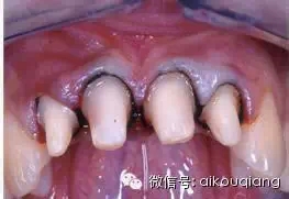 1401.webp.jpg 1401.webp.jpg