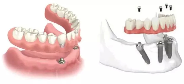 5000.webp.jpg 5000.webp.jpg