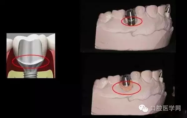 94.webp.jpg 94.webp.jpg