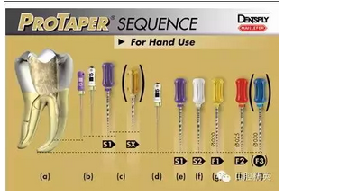 根管治療 根管治療