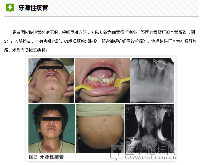 口腔疾病與全身系統(tǒng)性疾病的關(guān)系 口腔疾病與全身系統(tǒng)性疾病的關(guān)系