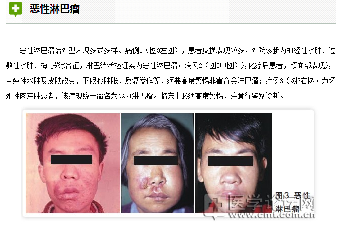 口腔疾病與全身系統(tǒng)性疾病的關(guān)系 口腔疾病與全身系統(tǒng)性疾病的關(guān)系