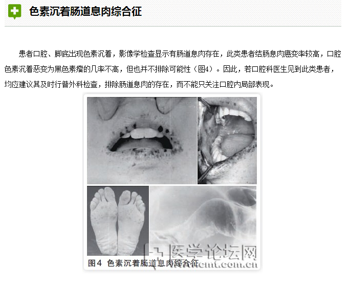 口腔疾病與全身系統(tǒng)性疾病的關(guān)系 口腔疾病與全身系統(tǒng)性疾病的關(guān)系