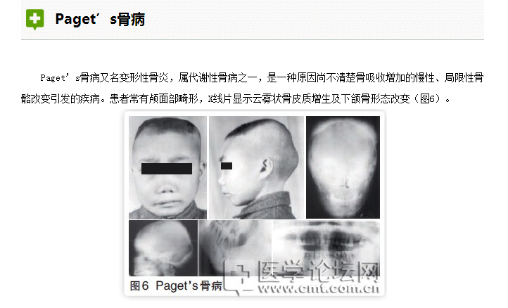 口腔疾病與全身系統(tǒng)性疾病的關(guān)系 口腔疾病與全身系統(tǒng)性疾病的關(guān)系