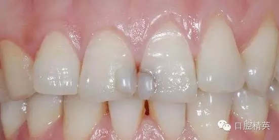 1.webp.jpg 1.webp.jpg